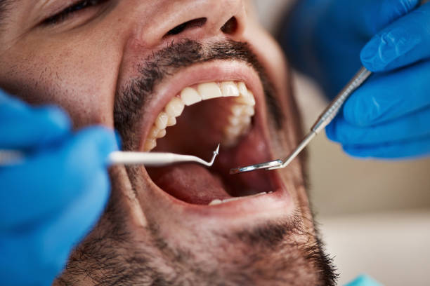 Best After-Hours Emergency Dentist in Dublin, VA